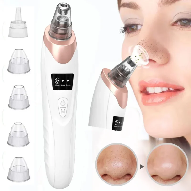 Deep Pore Cleaner and Blackhead Remover - Image 4